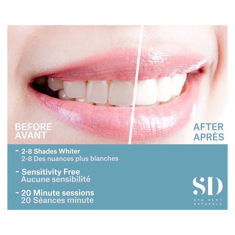 SD Naturals Professional Teeth Whitening Kit - Nutrition Plus